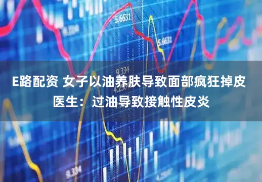 E路配资 女子以油养肤导致面部疯狂掉皮 医生：过油导致接触性皮炎